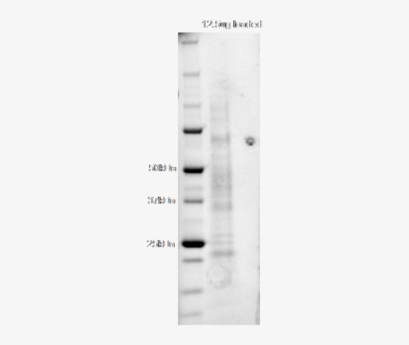 Sds Page Of Purified Protein - User Guide, transparent png