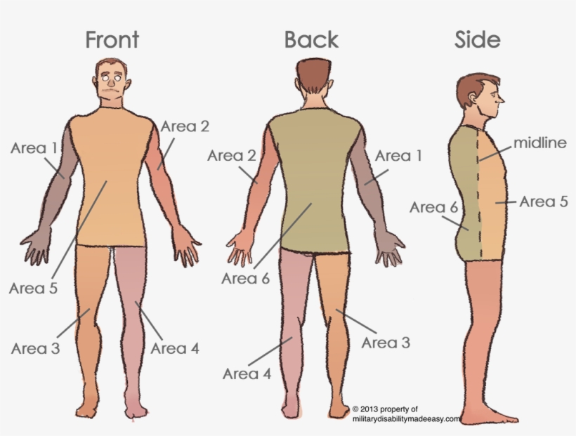 Scar Areas 2 - Body Surface Area, transparent png