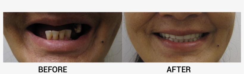 Amm Has Restored The Smiles Of 56 Women To Date With - Close-up, transparent png