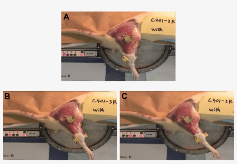 Pictures Of The Automatic Arthrometer Developed By - Joint, transparent png