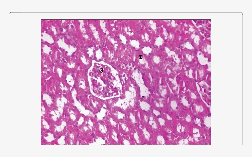 Light Microscopy Of Kidney In Mscs Group Showed Normal - Kidney, transparent png