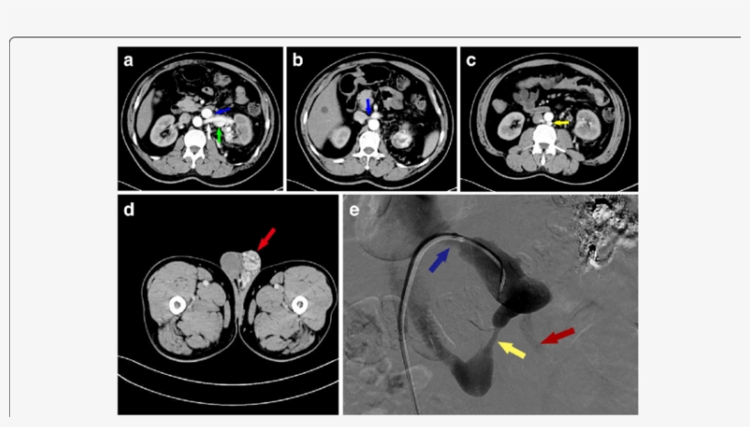 Additional Radiological Examination Of The Patient - Common Fig, transparent png