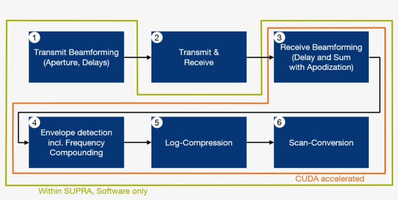 The Usual Processing Steps Contained In A Usual Ultrasound - Diagram, transparent png