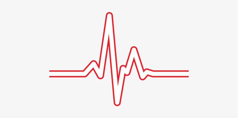 Ekg Clip Ecg Lead - Ekg - 480x376 PNG Download - PNGkit