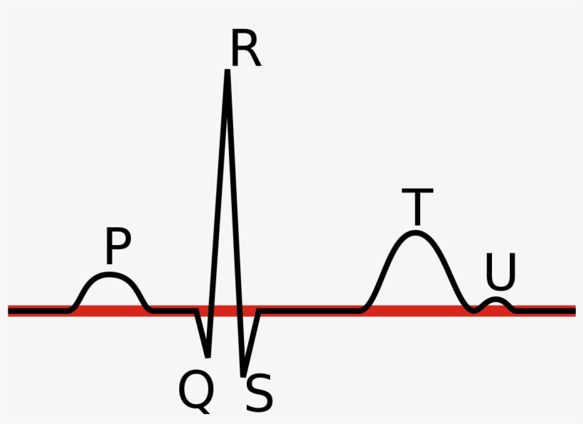 File Linia Izoelektryczna Wikimedia - Vector Espacial Del Complejo Qrs, transparent png