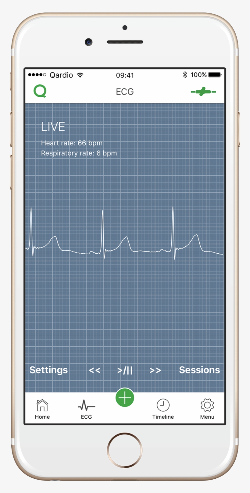Ecg/ekg Trace Qardio App, transparent png