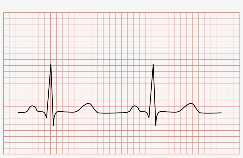 Open - Normal Ecg, transparent png