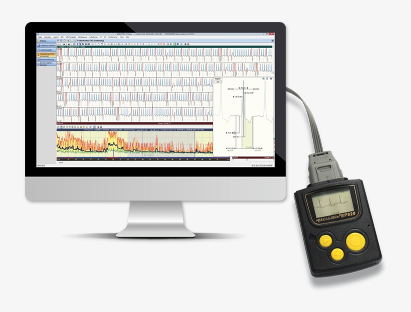 Holter Ecg - Computer Monitor, transparent png