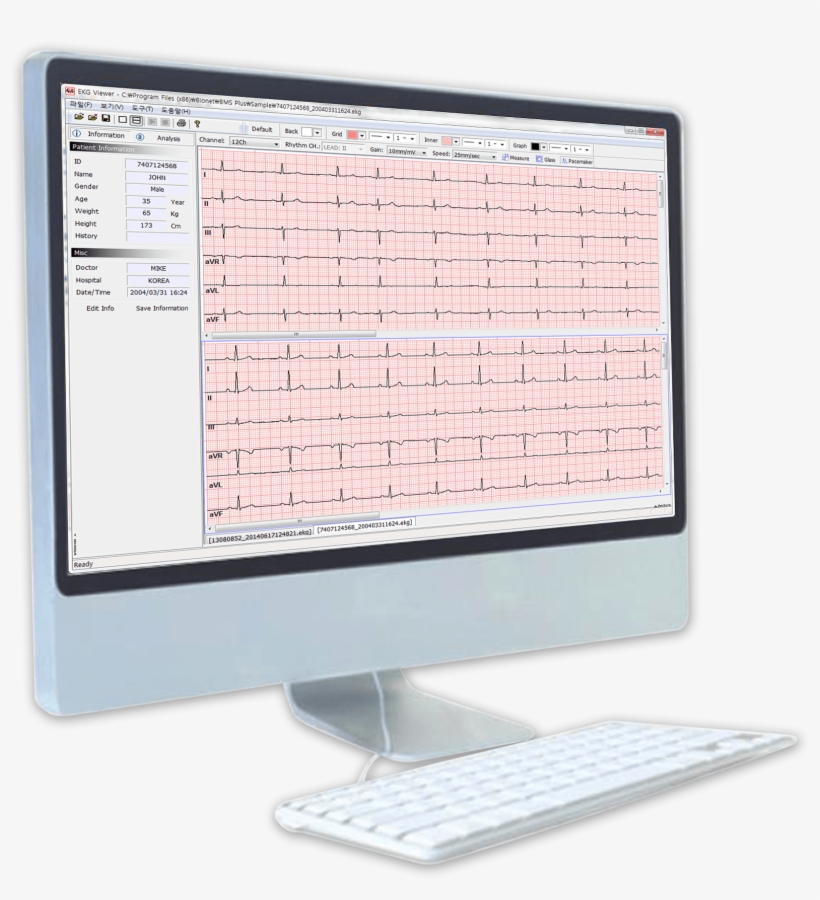Bms-plus Bionet Ekg/ecg/spirometer Software - Software, transparent png