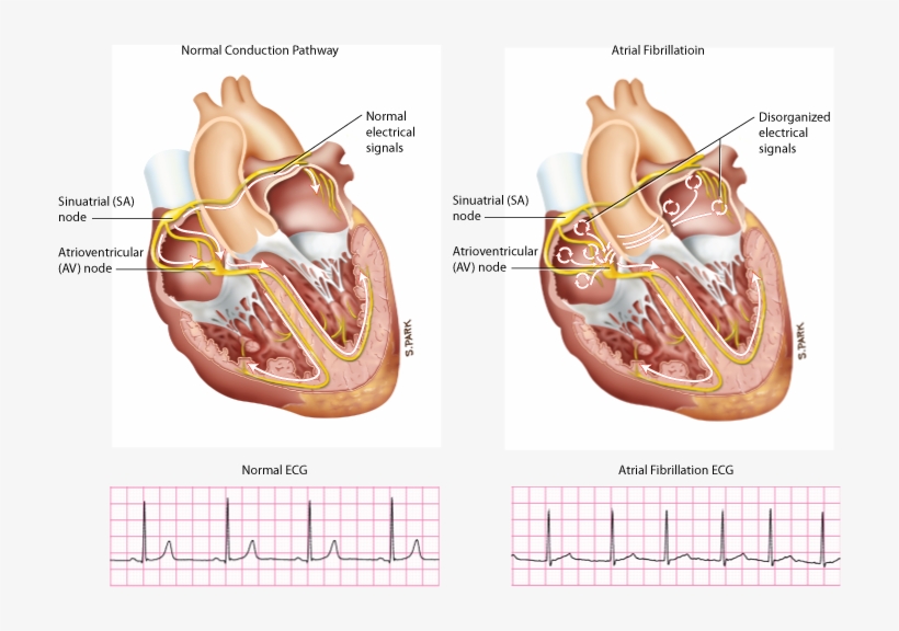 Diagram, transparent png