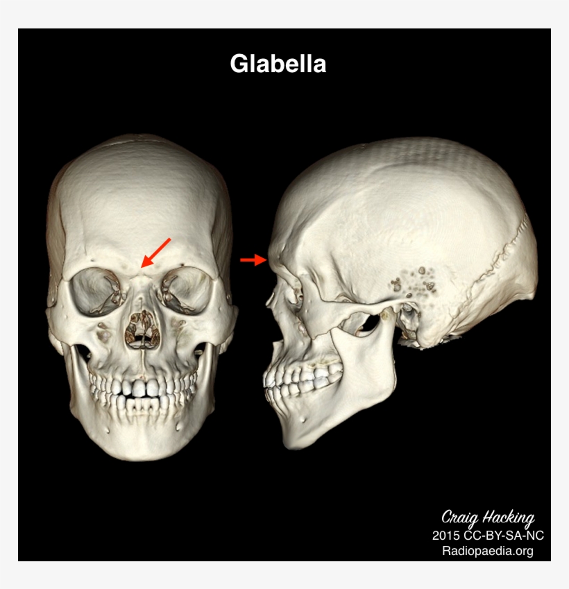 Radiology Quiz 40462 - Nasion Skull, transparent png