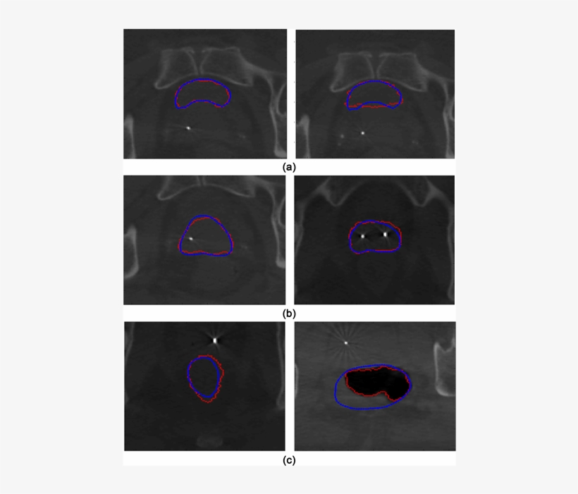 Contour Comparison Between The Segmentation And Ground - Circle, transparent png