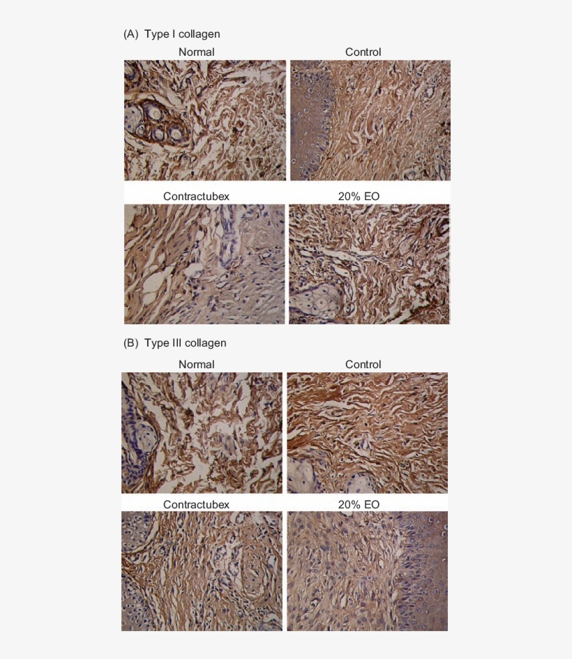 Immunohistochemical Reactivities Of Collagens I And - Granite, transparent png