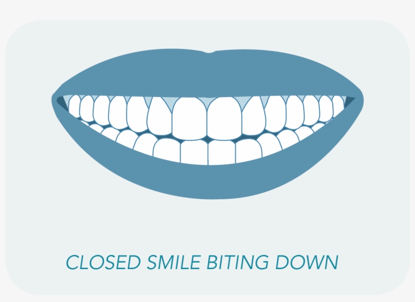 Want To Have An Impressions Doctor See If You're A, transparent png