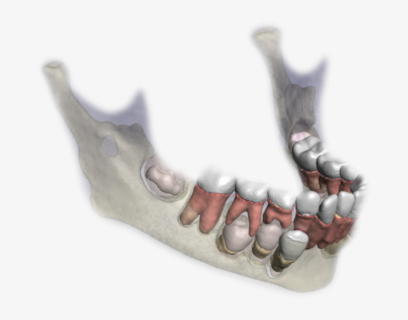 3d Model Of A Jaw - Human Tooth, transparent png