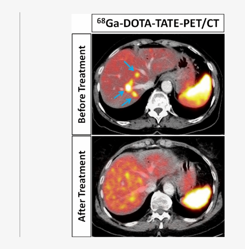 Download - Dota-tate, transparent png