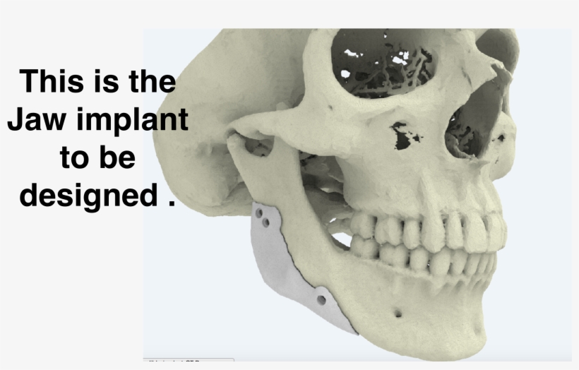 Jaw Implant Idea - Danger This Is Sparta, transparent png