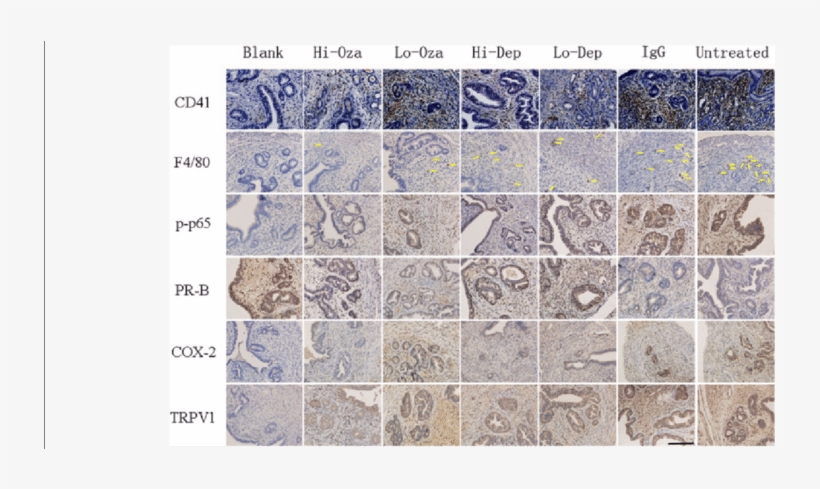 Representative Photomicrographs Of Indicated Immunostaining, transparent png