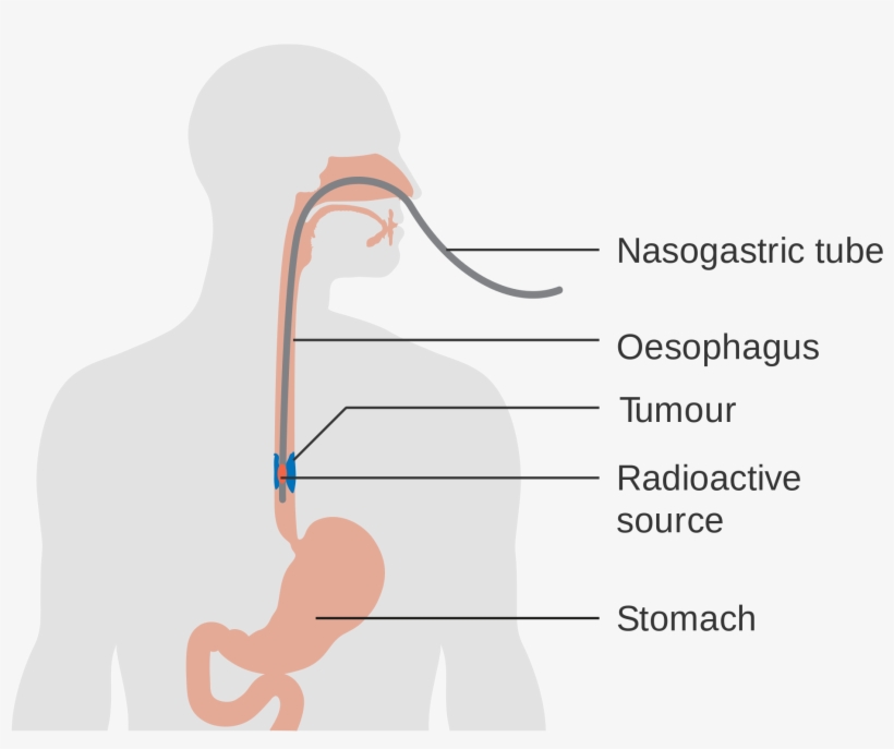 Open - Diagram Of The Oesophagus, transparent png