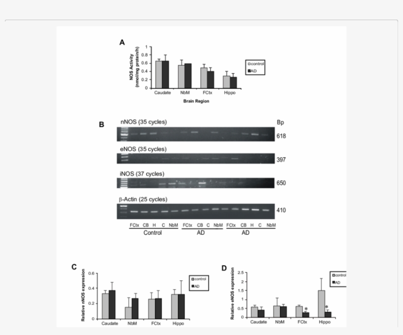 Pattern Of Nos Expression In Tissue Lysates Of Caudate, - Diagram, transparent png