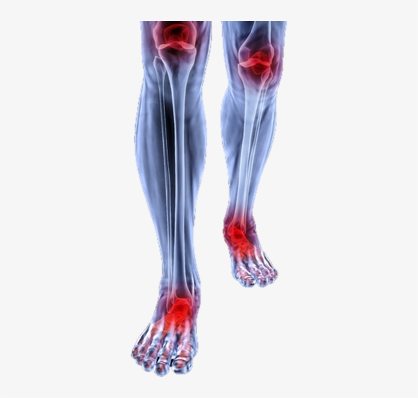 foot pain and knee pain joint pain transparent background 703x703 png download pngkit foot pain and knee pain joint pain