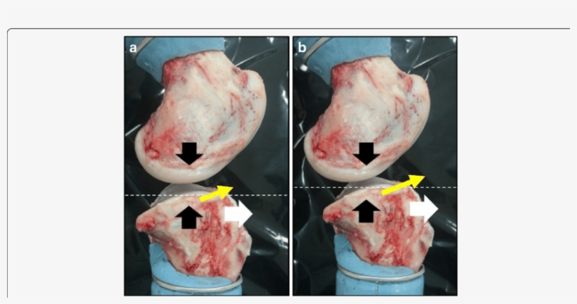 Lateral View Of Porcine Knee Joint - Varus Deformity, transparent png