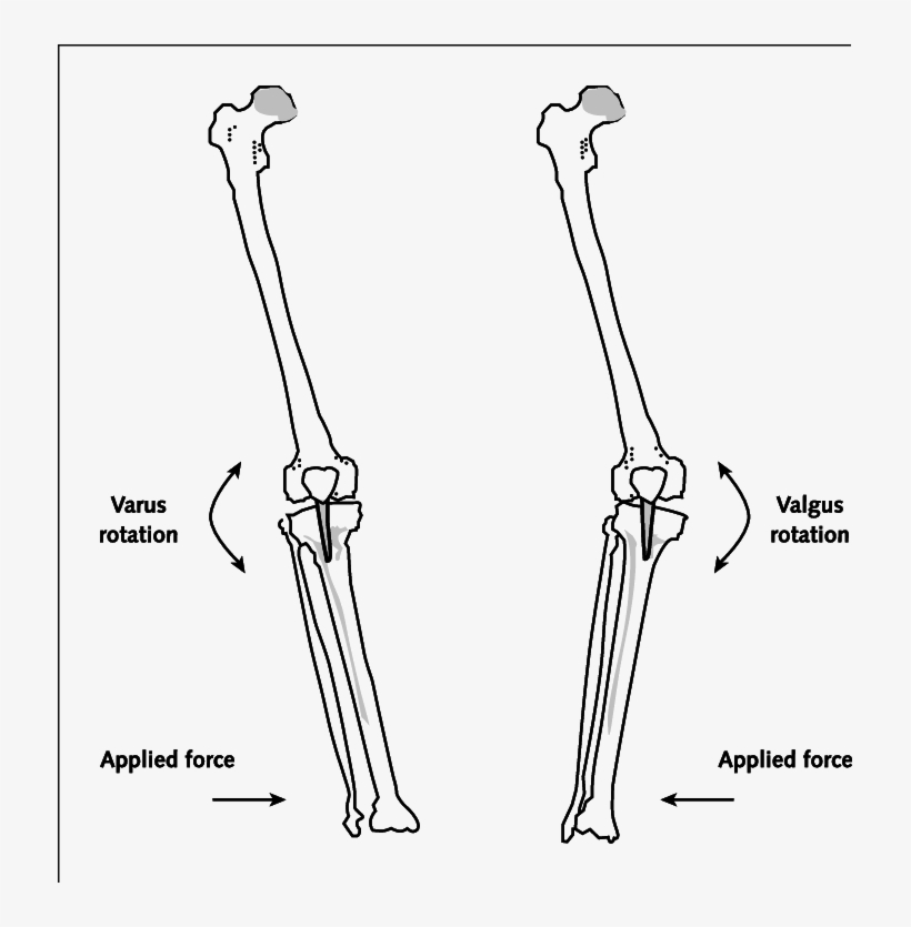 Direction Of Force Application And The Resulting Motion - Valgus Varus Force, transparent png