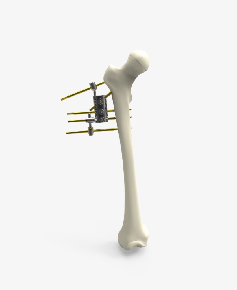 The Fixator Allows 360 Degree Rotational Motion, Flexion - Trumpet, transparent png