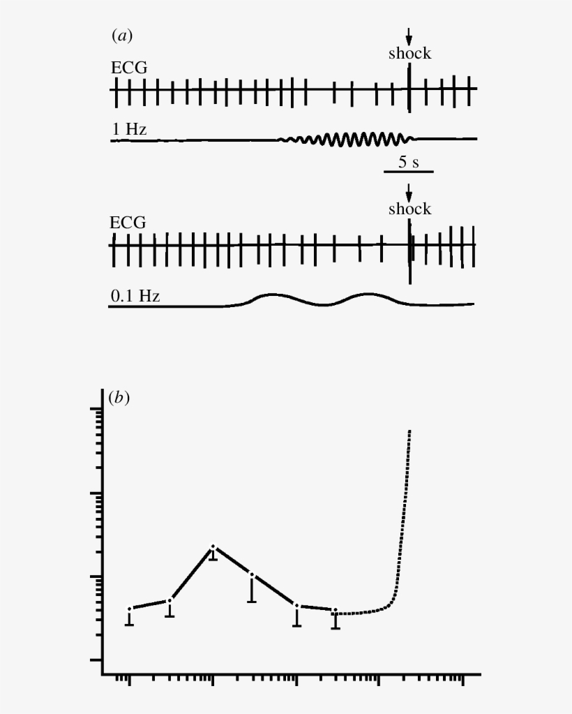 Conditioned Cardiac Response (slowing Of The Heart - Diagram, transparent png