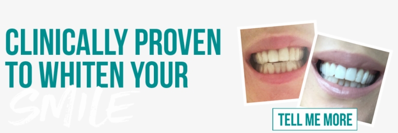 Billion Dollar Whitening Non Peroxide Home Teeth Whitening - Ocd Obsessive Caleb Disorder Throw Blanket, transparent png