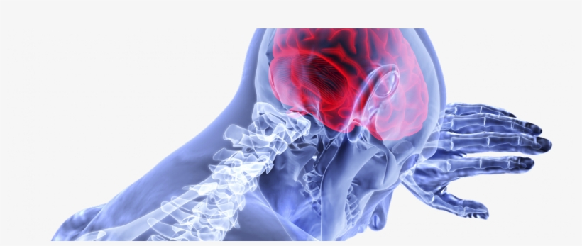 Graphic Showing Brain And Skeleton - Brain Concussion Transparent, transparent png