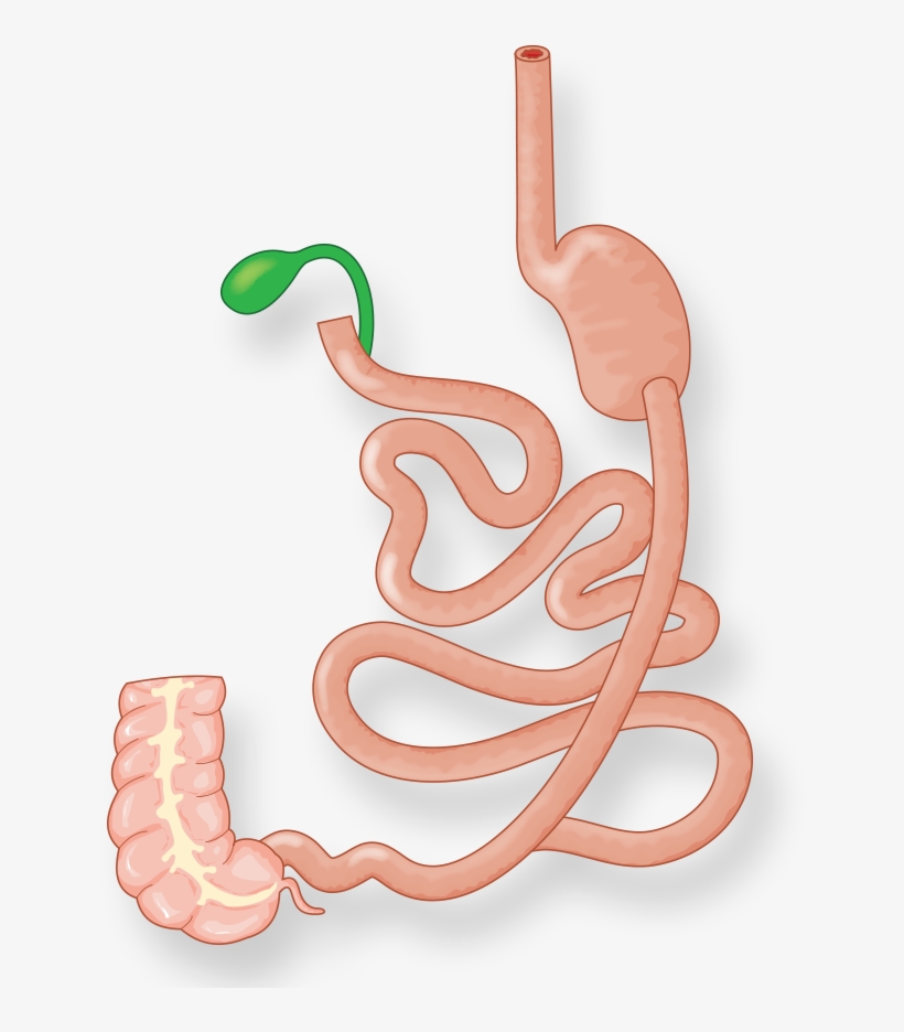 Illustration Of Intestines And Stomach After Duodenal - Duodenal Switch, transparent png