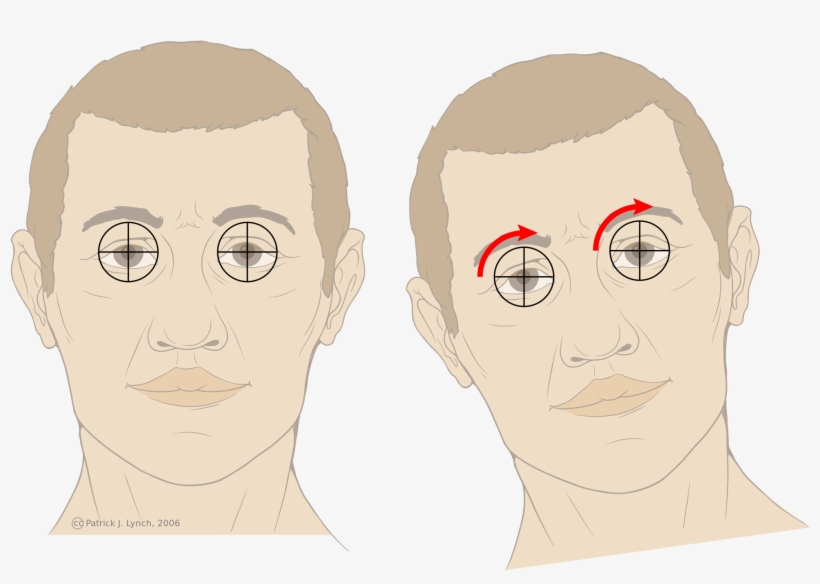 Open - Vestíbulo Ocular, transparent png