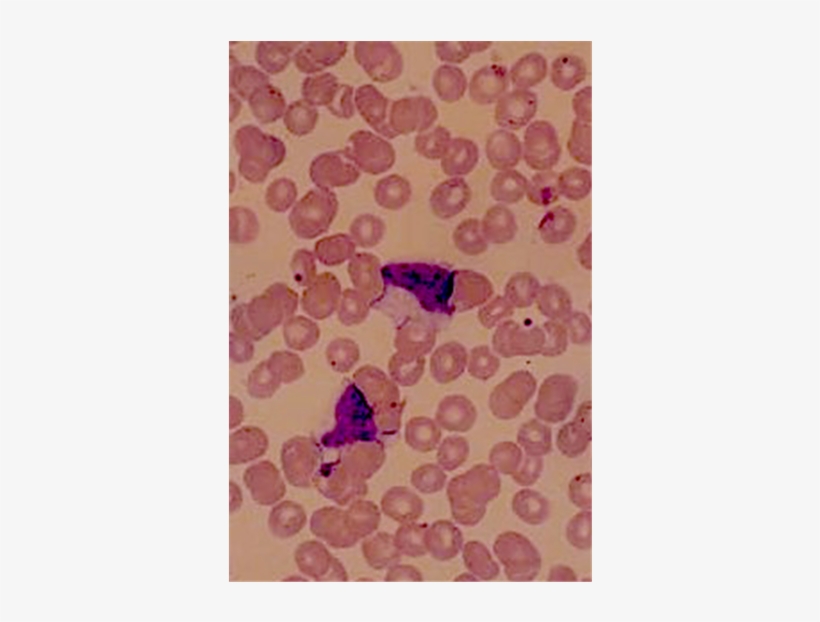 Peripheral Blood Smear, transparent png
