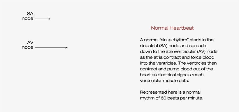 Normal Heartbeat Heart Block Bradycardia Atrial Tachycardia - Ventricular Fibrillation Heart, transparent png