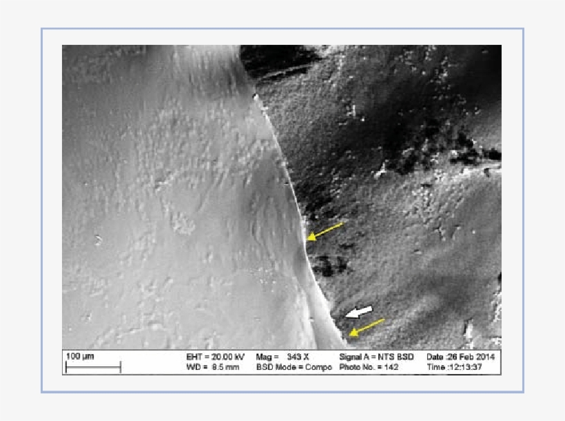 Sem-image Of An Anterior Lens Capsule Following Manual - Capsulorhexis, transparent png