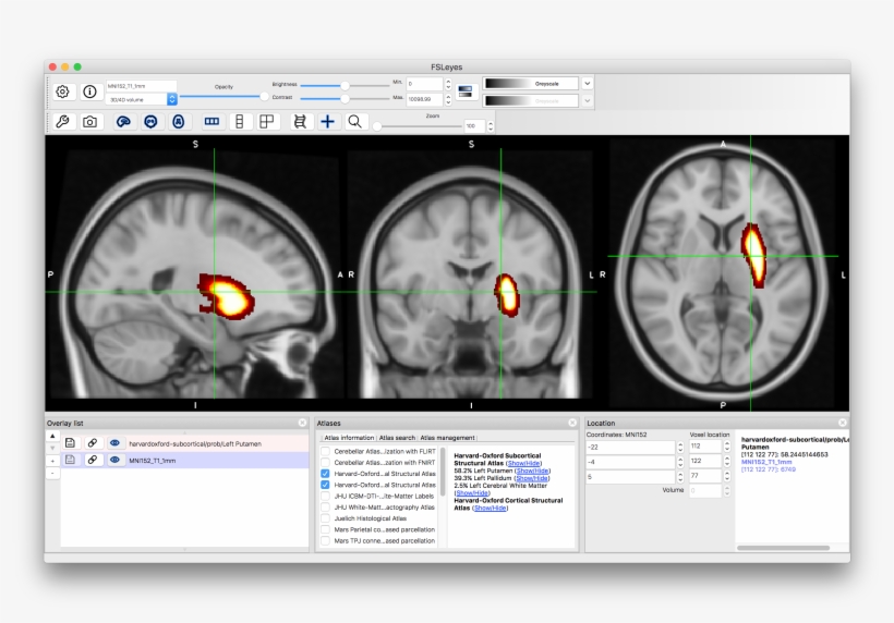 You Can Do The Same Thing For The "harvard-oxford Cortical, transparent png