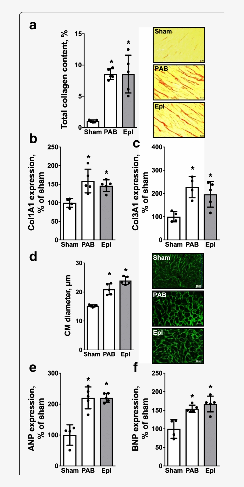 Eplerenone Has No Direct Effect On Pressure Overload-induced, transparent png