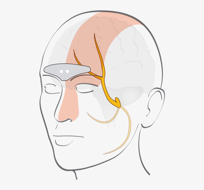 Cefaly, transparent png