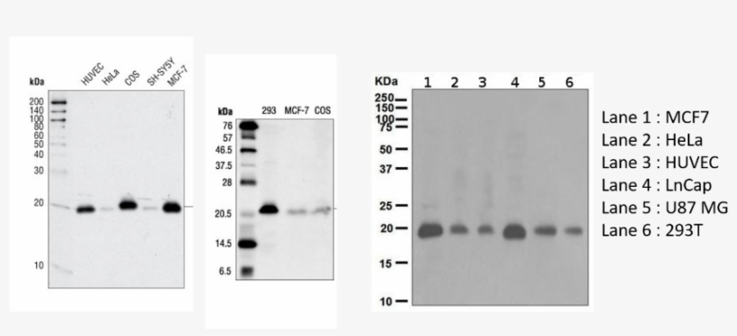Cdkn1a Antibodies Cst Abcam Right, transparent png