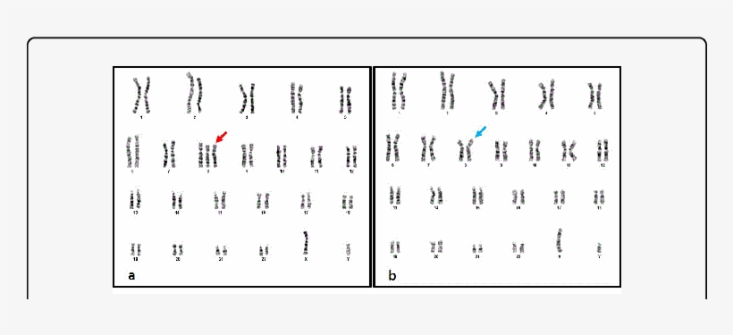 Karyotype 47,xy, 8 , B - Karyotype, transparent png