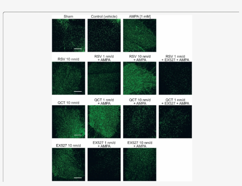 Effect Of Rsv, Qct And Ex527 On Spinal Astroglial Cell, transparent png