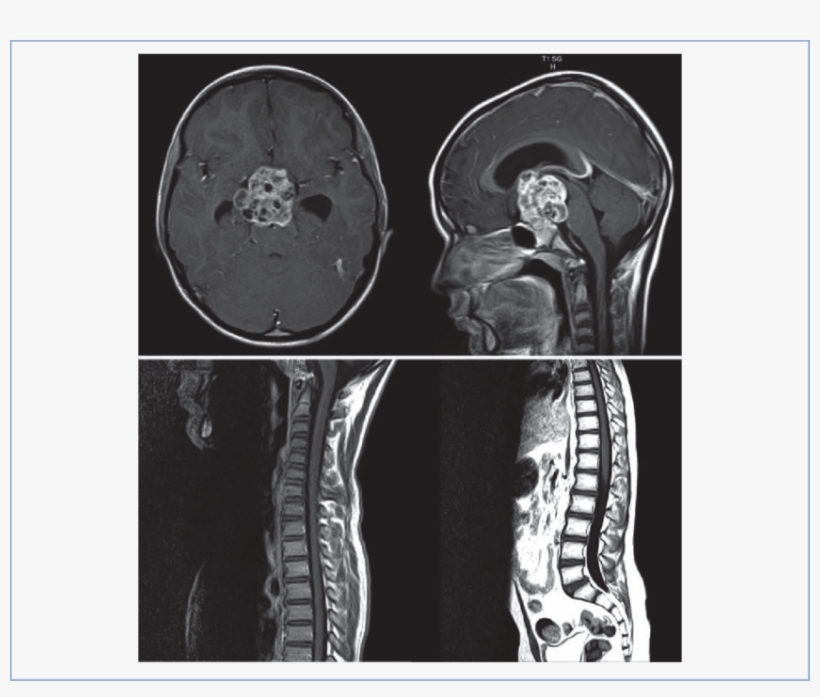 Human Spine White Png Exray, transparent png