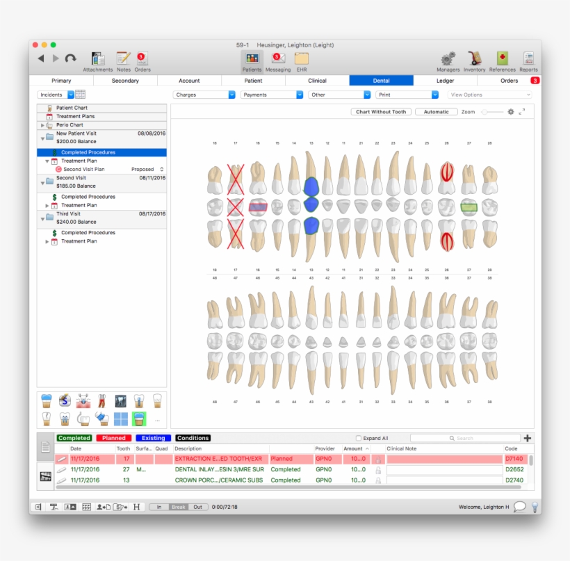 By Default, Macpractice Will Be Set To The Automatic, transparent png