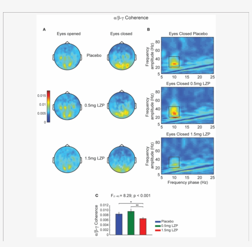 High Lzp Dosage Decreases Alpha Phase To Beta-low Gamma, transparent png