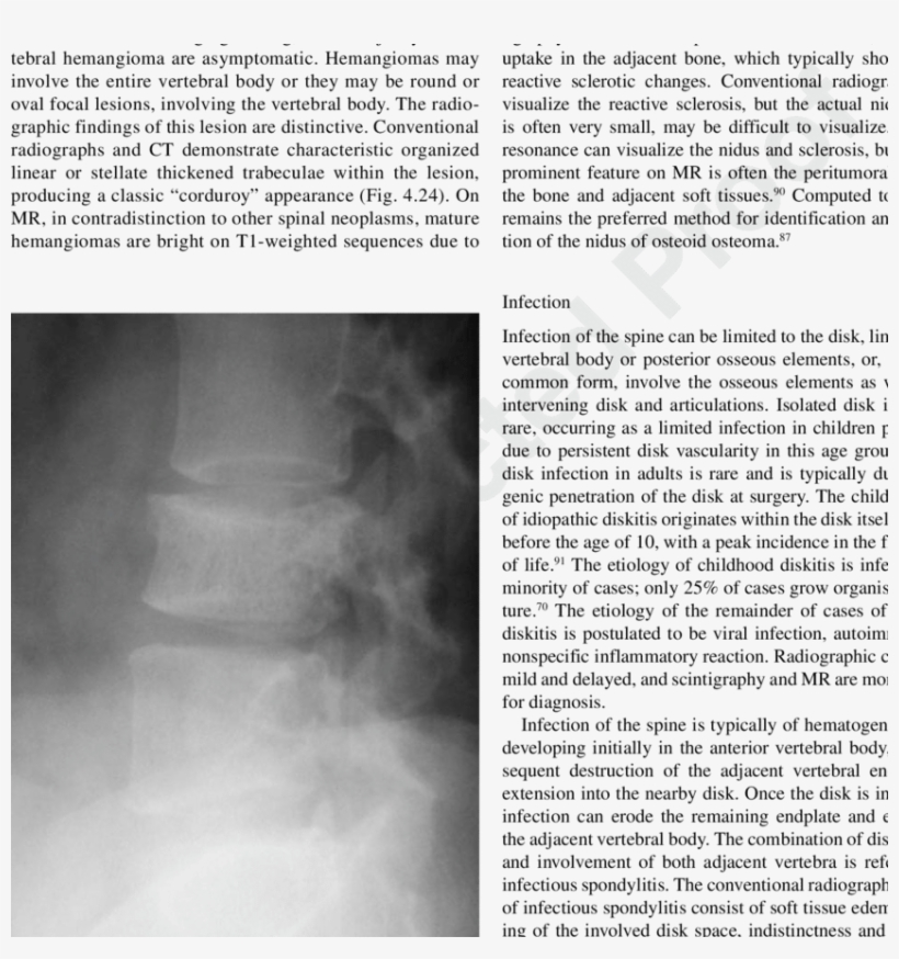 A Lateral Radiograph Of The Lumbar Spine In A 28 Year, transparent png