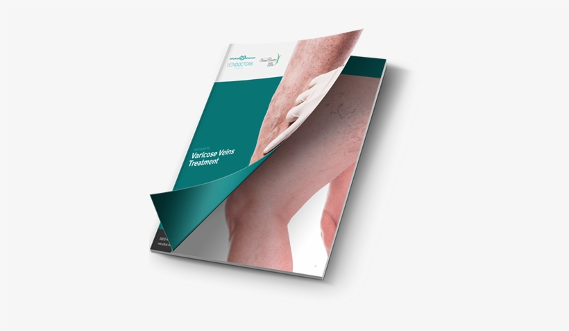 Download Your Free Guide To Varicose Veins - Varicose Veins, transparent png