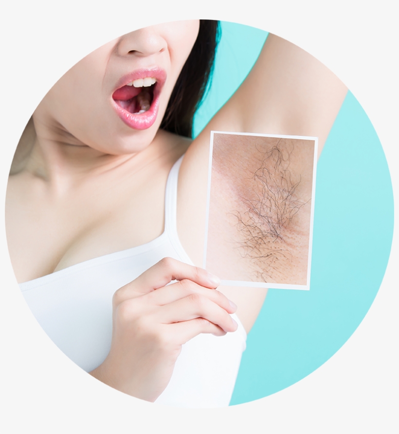 Laser Hair Removal Treatment, transparent png