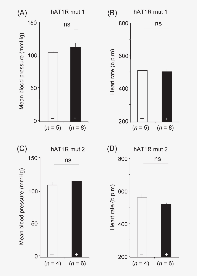 Telemetry Recording Of Blood Pressure And Heart Rate - Myosin Light-chain Kinase, transparent png