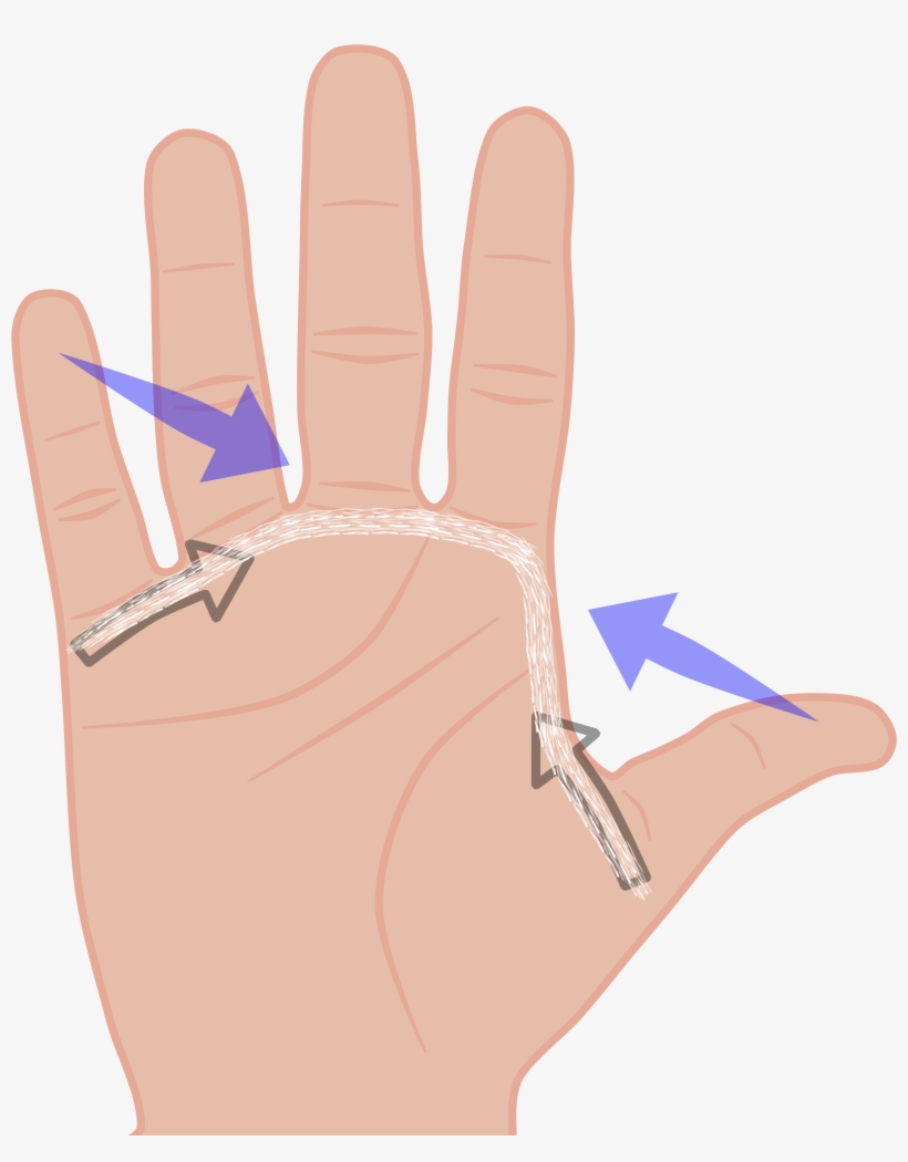 Is That Dupuytren Often Affects A Line Of Tissue Which - Glove, transparent png